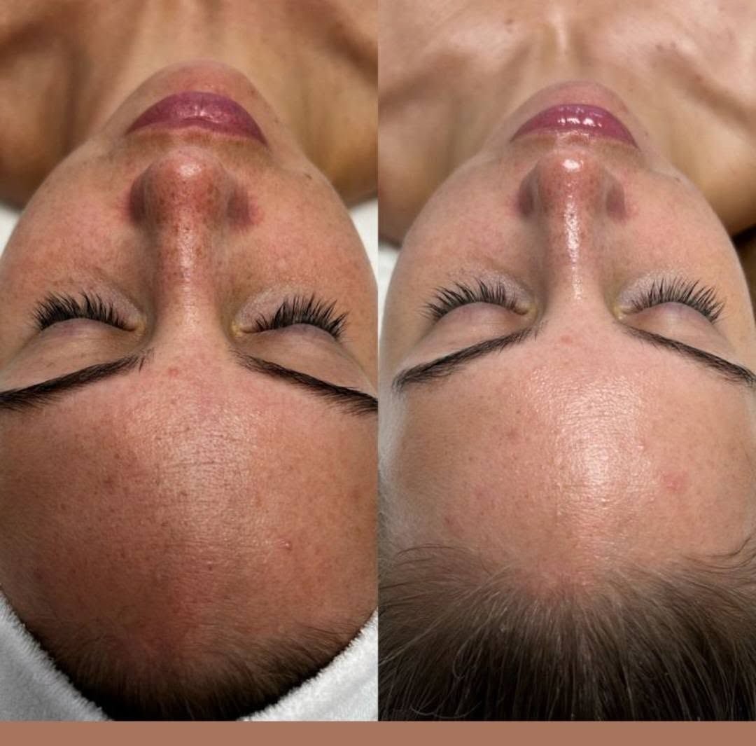 Gezichtsbehandeling in de salon